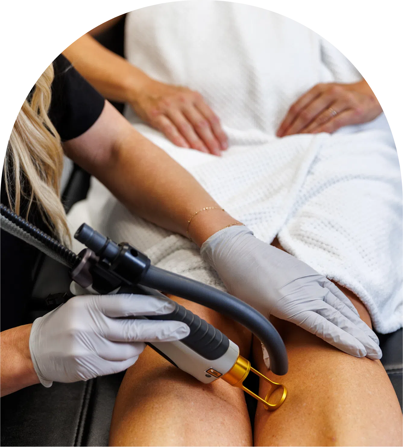 Laser hair removal on legs