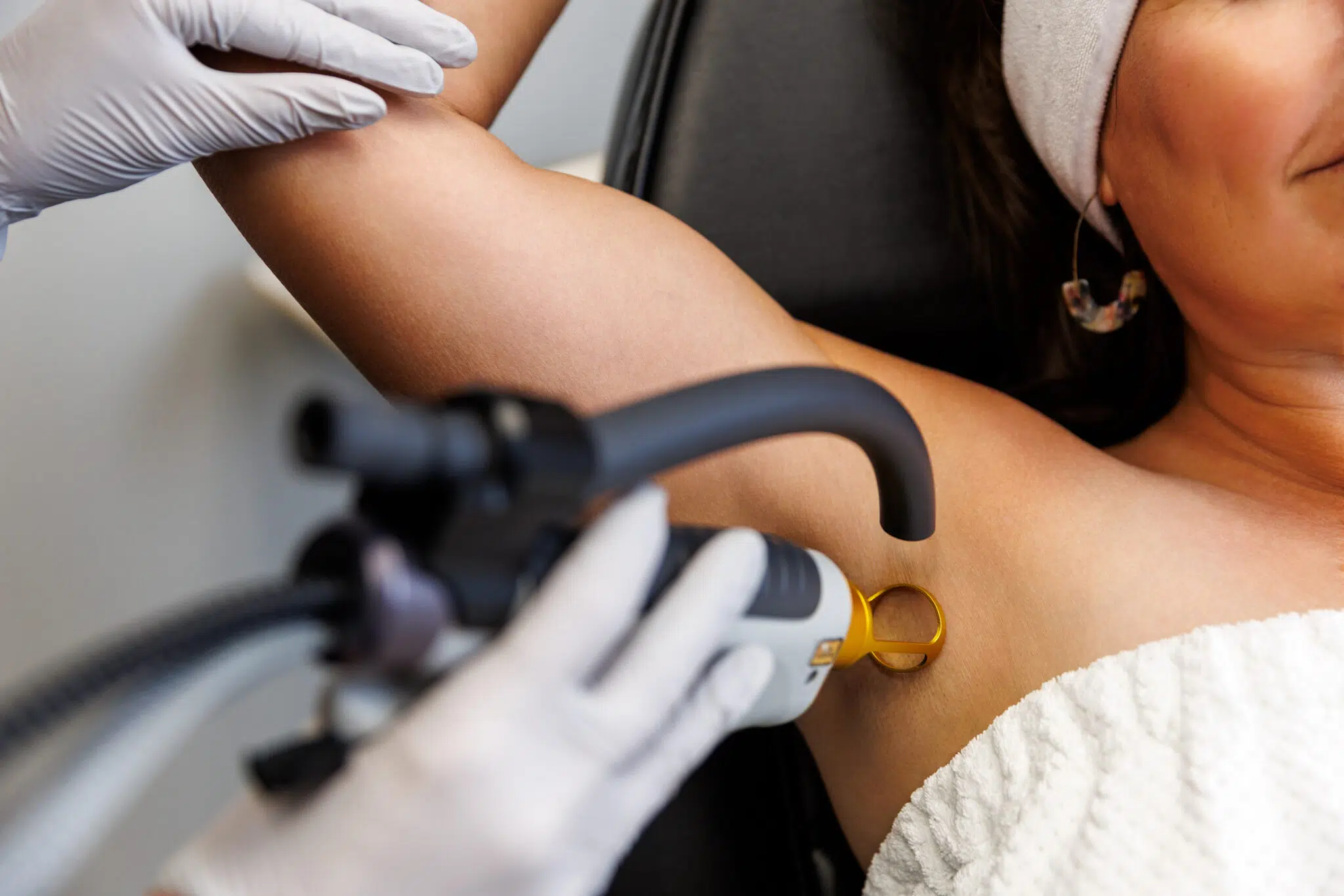 Laser treatment being performed on woman's underarm