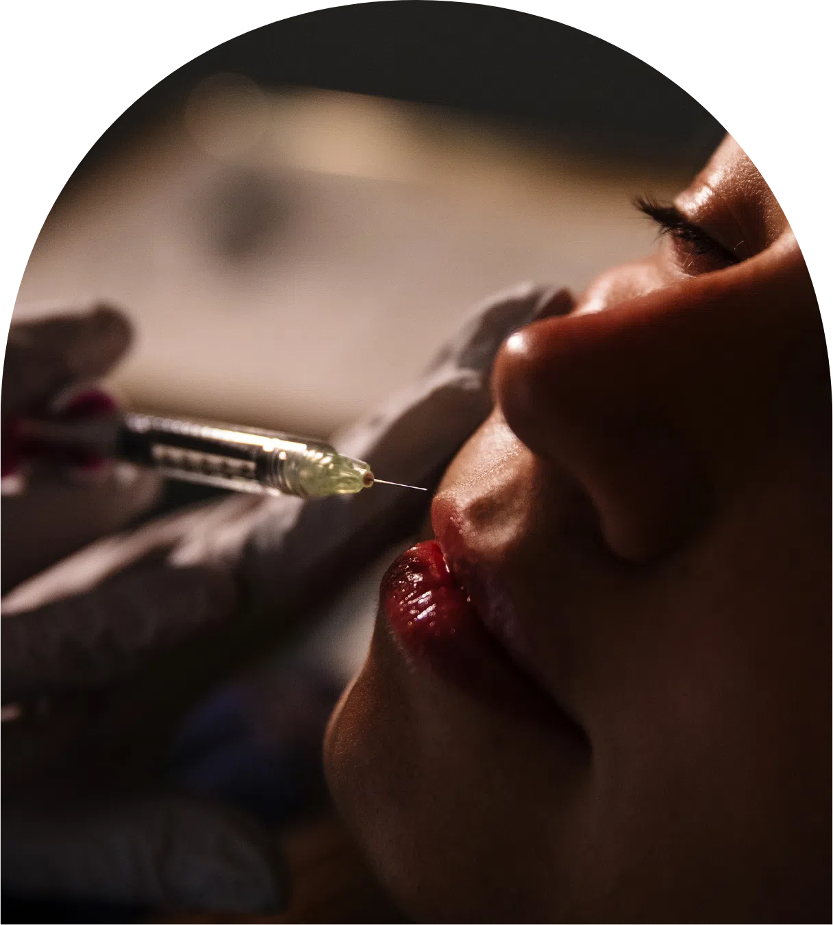 Dermal fillers in Manhattan, KS