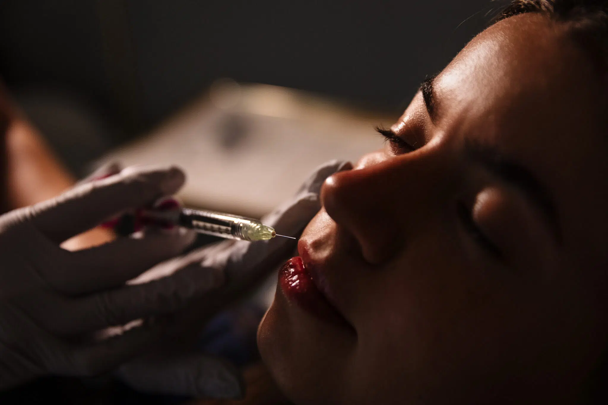 Woman receiving lip filler treatment
