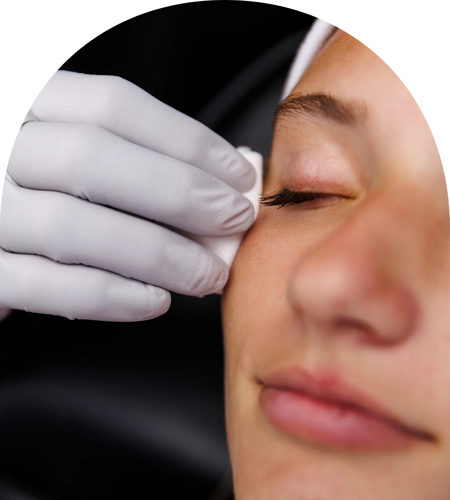 Facial injectable treatment at Lemonade Aesthetics in Manhattan, KS